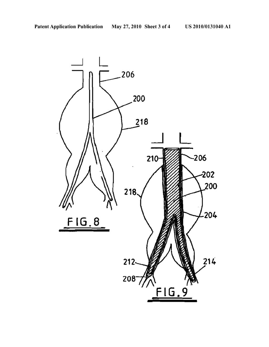 Apparatus and Methods for Repairing Aneurysms - diagram, schematic, and image 04