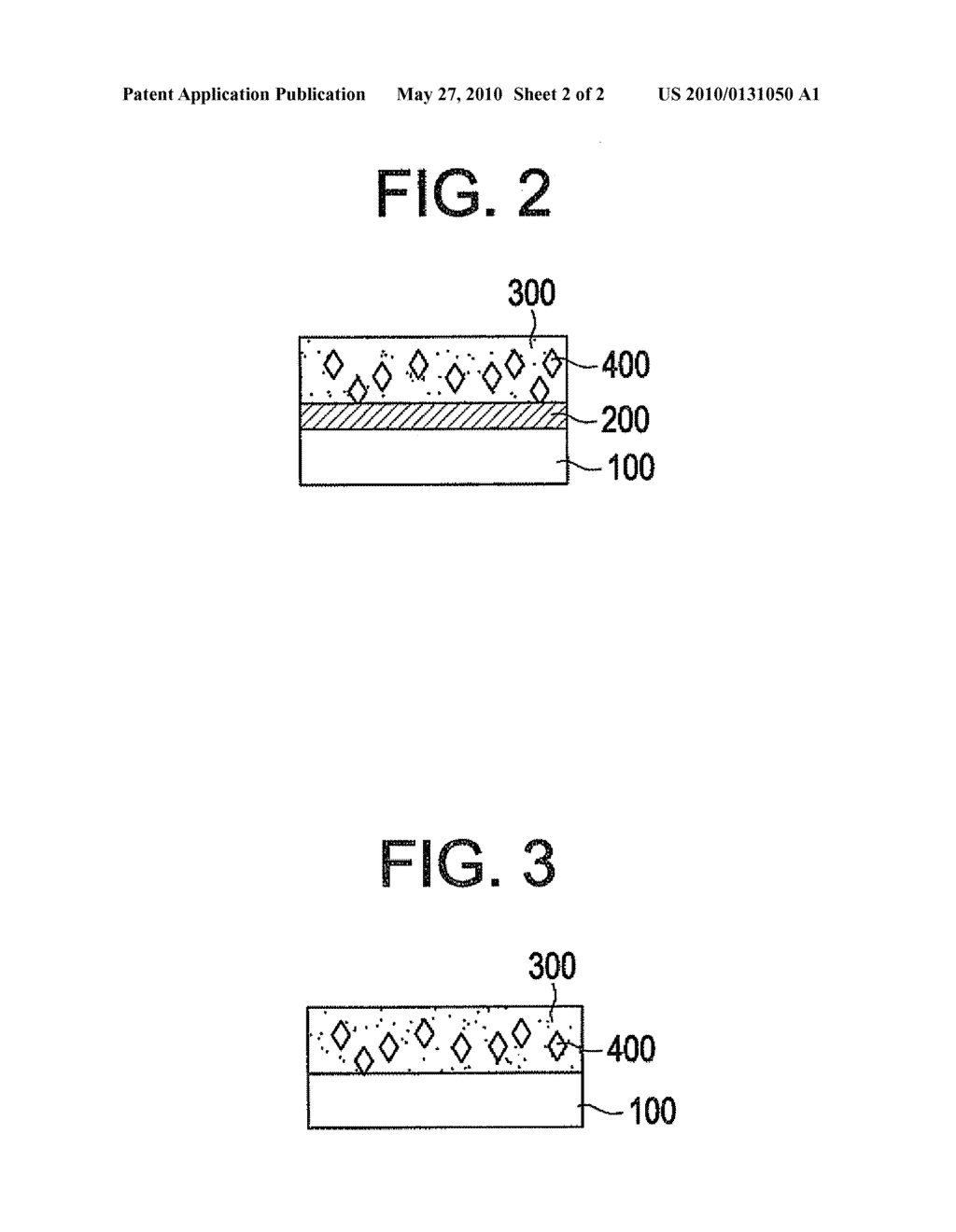 ABSORBABLE STENT HAVING A COATING FOR CONTROLLING DEGRADATION OF THE STENT AND MAINTAINING pH NEUTRALITY - diagram, schematic, and image 03