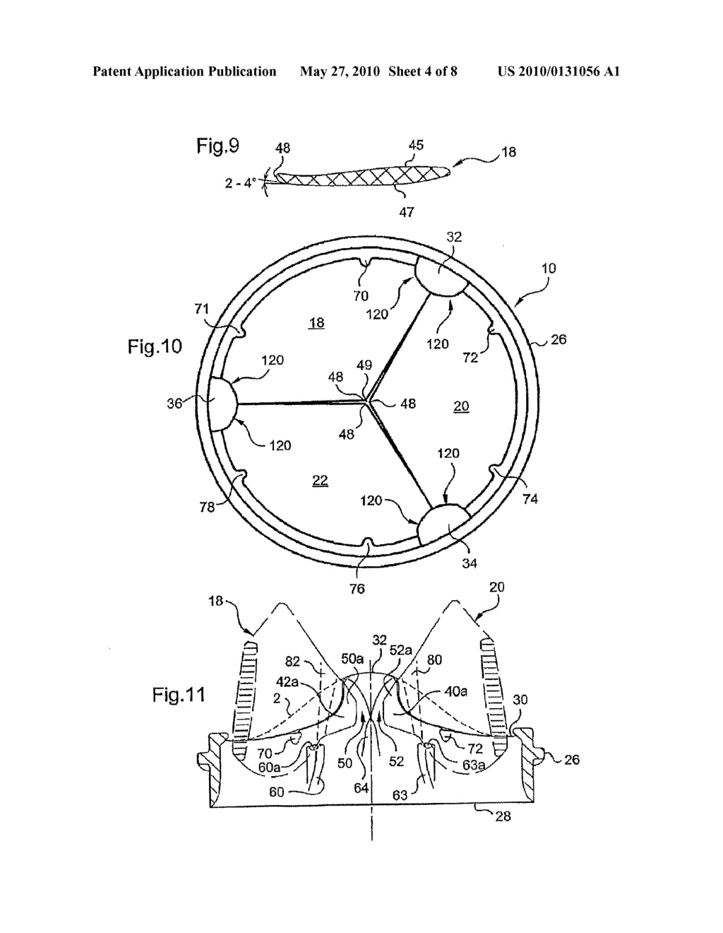 MECHANICAL PROSTHETIC HEART VALVE - diagram, schematic, and image 05