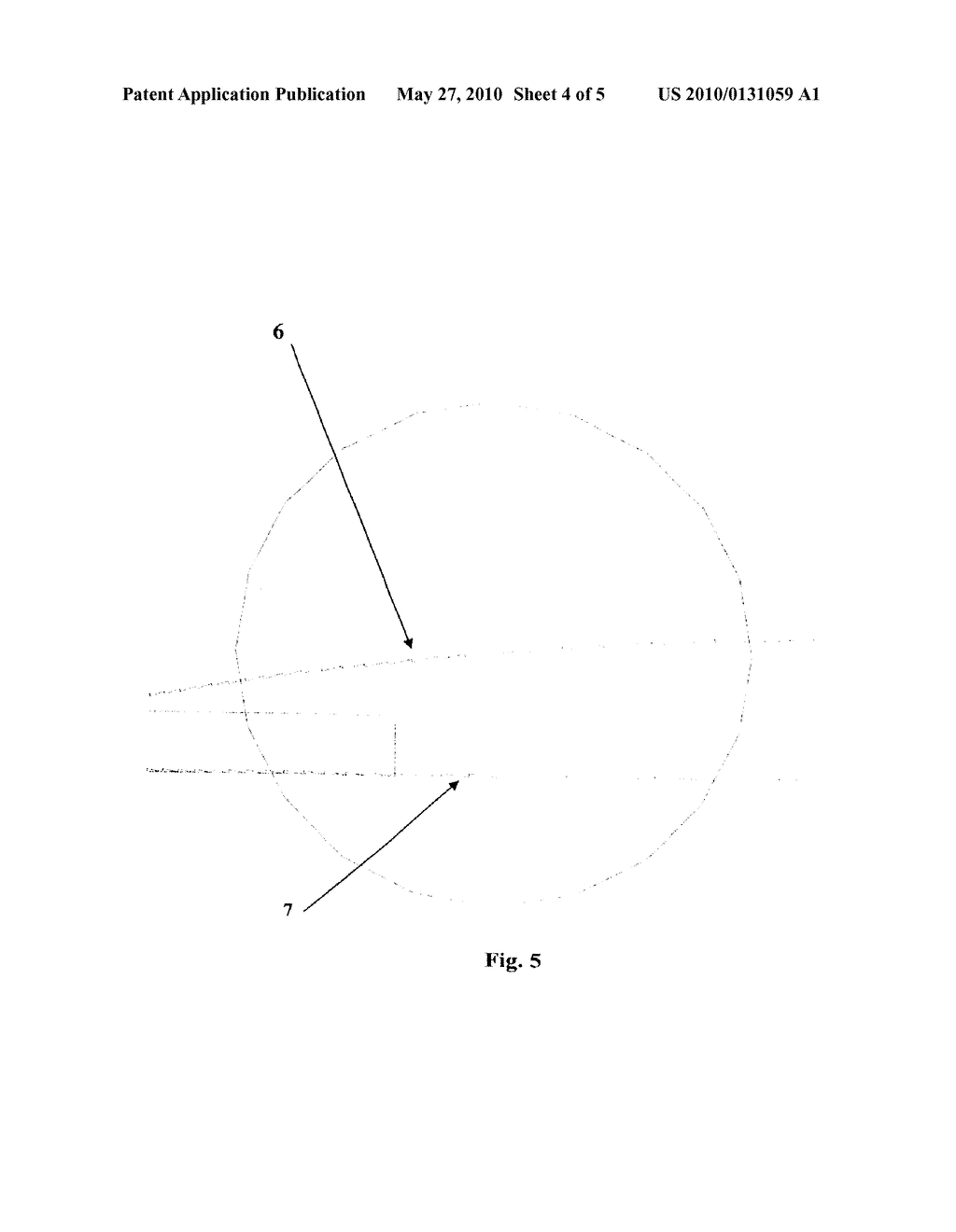 INTRAOCULAR LENS OPTIC - diagram, schematic, and image 05