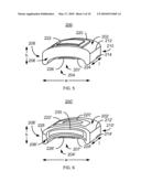 METHOD AND SYSTEM FOR PATELLA TENDON REALIGNMENT diagram and image