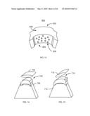 METHOD AND SYSTEM FOR PATELLA TENDON REALIGNMENT diagram and image