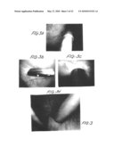 Methods and apparatus for image recognition and dictation diagram and image