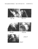 Methods and apparatus for image recognition and dictation diagram and image