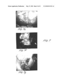 Methods and apparatus for image recognition and dictation diagram and image