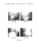 Methods and apparatus for image recognition and dictation diagram and image