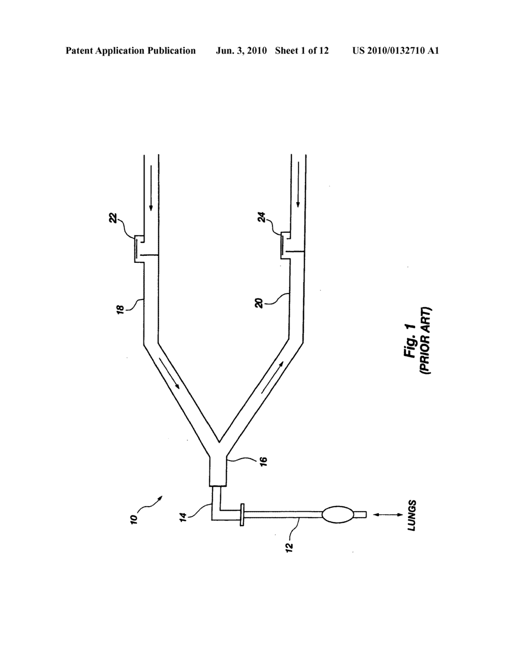 APPARATUS AND METHOD FOR NON-INVASIVELY MEASURING CARIDAC OUTPUT - diagram, schematic, and image 02