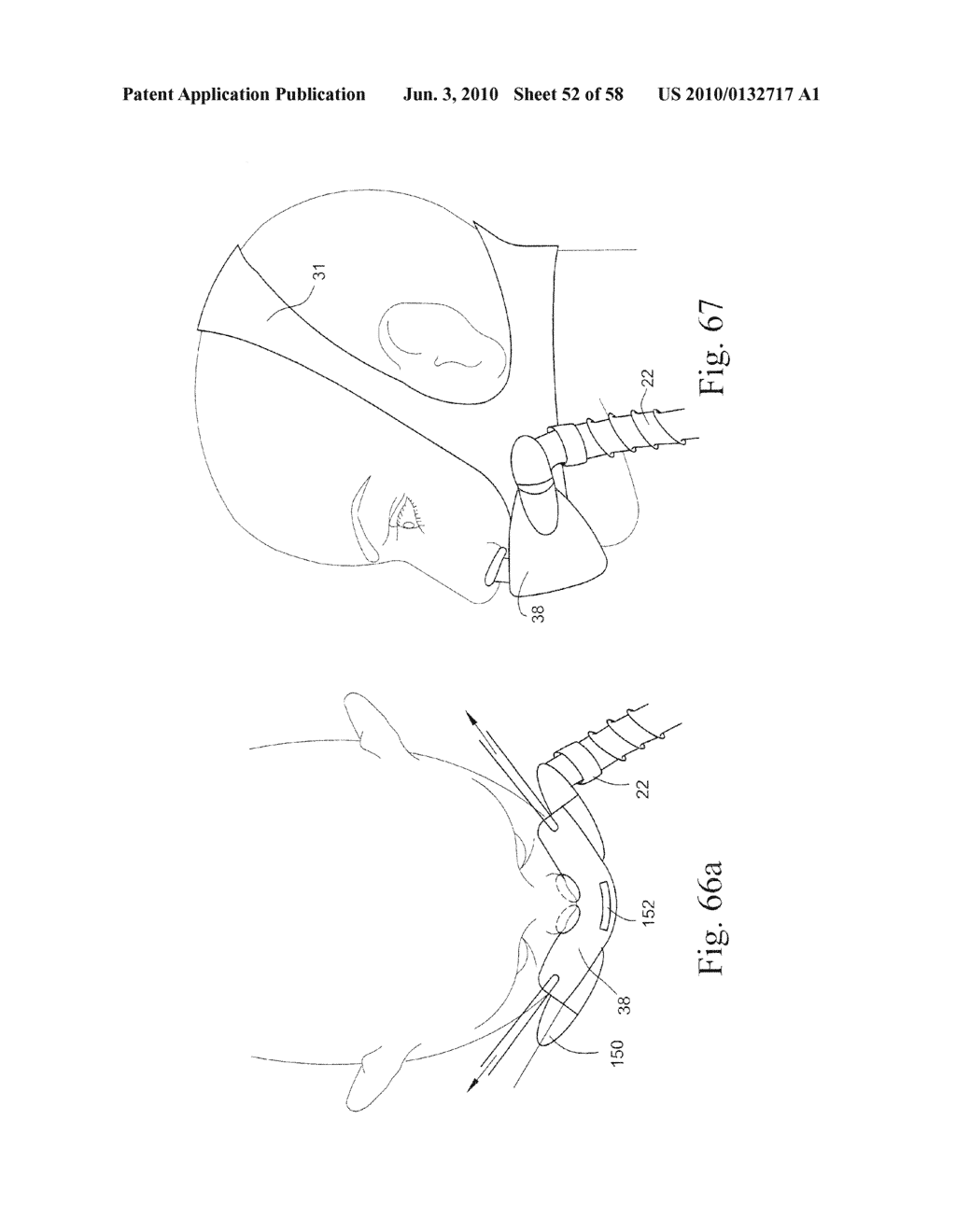 COMPACT ORONASAL PATIENT INTERFACE - diagram, schematic, and image 53