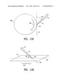 METHOD AND APPARATUS FOR MANUFACTURING AN ENDOVASCULAR GRAFT SECTION diagram and image