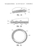 METHOD AND APPARATUS FOR MANUFACTURING AN ENDOVASCULAR GRAFT SECTION diagram and image