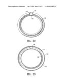 METHOD AND APPARATUS FOR MANUFACTURING AN ENDOVASCULAR GRAFT SECTION diagram and image