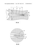 Method for the Enhancement of Injection Activities and Stimulation of Oil and Gas Production diagram and image