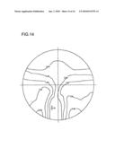 PROGRESSIVE-POWER LENS diagram and image