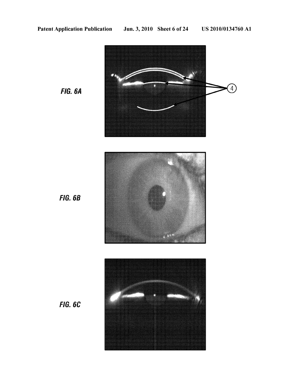 SYSTEMS AND METHODS FOR IMPLANTING AND EXAMINING INTRAOCULAR LENS - diagram, schematic, and image 07