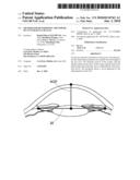 METHOD FOR DETERMINING THE POWER OF AN INTRAOCULAR LENS diagram and image