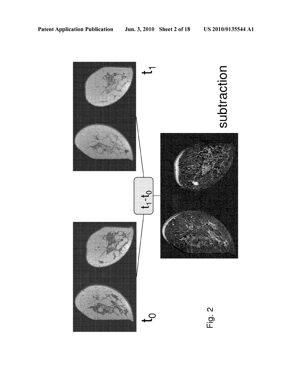 Method of registering images, algorithm for carrying out the method of registering images, a program for registering images using the said algorithm and a method of treating biomedical images to reduce imaging artefacts caused by object movement - diagram, schematic, and image 03