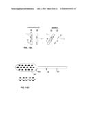 IMAGE-BASED CHARACTERIZATION OF IMPLANTED MEDICAL LEADS diagram and image