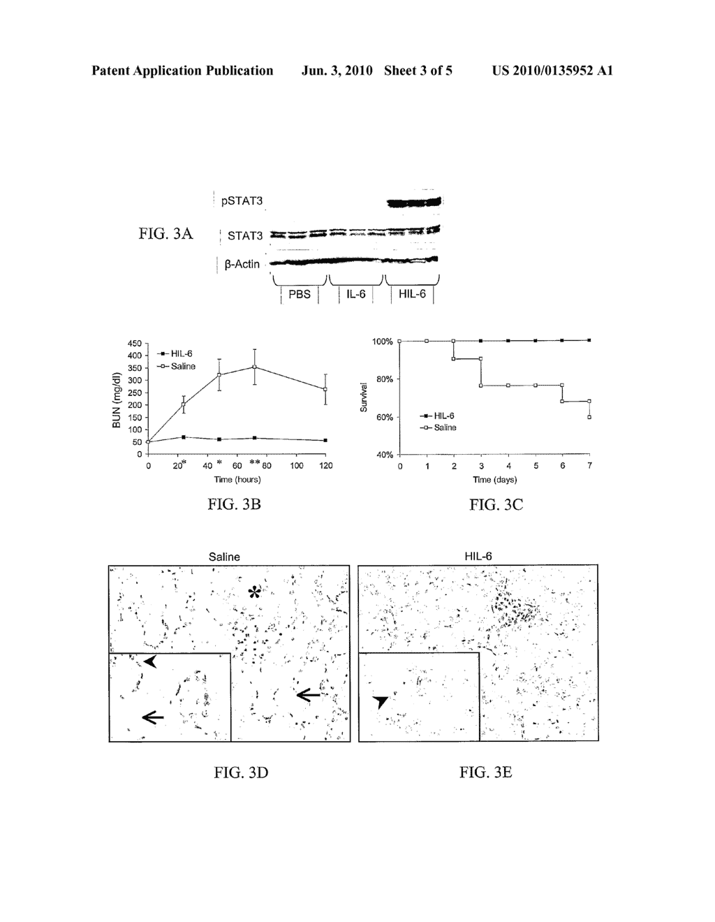 METHODS FOR THE TREATMENT OF RENAL FAILURE - diagram, schematic, and image 04