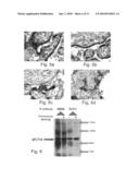 VARIANTS OF VEGFR AND THEIR USE IN THE DIAGNOSIS AND TREATMENT OF PREGNANCY ASSOCIATED MEDICAL CONDITIONS diagram and image