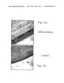 VARIANTS OF VEGFR AND THEIR USE IN THE DIAGNOSIS AND TREATMENT OF PREGNANCY ASSOCIATED MEDICAL CONDITIONS diagram and image