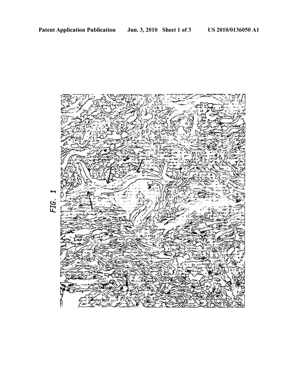 Extracellular Matrix Materials as Vaccine Adjuvants for Diseases Associated with Infectious Pathogens or Toxins - diagram, schematic, and image 02