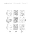 Composition for Promoting Cartilage Formation or Repair Comprising a NELL Gene Product and Method of Treating Cartilage-Related Conditions Using Such Composition diagram and image