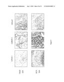 Composition for Promoting Cartilage Formation or Repair Comprising a NELL Gene Product and Method of Treating Cartilage-Related Conditions Using Such Composition diagram and image