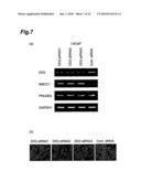 CANCER MARKER AND THERAPEUTIC AGENT FOR CANCER diagram and image