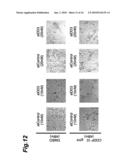 CANCER MARKER AND THERAPEUTIC AGENT FOR CANCER diagram and image