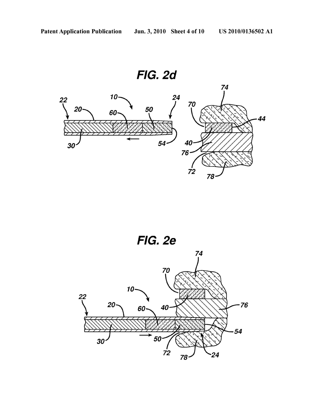 MEDICINAL IMPLANT DEVICE AND CARTRIDGE - diagram, schematic, and image 05