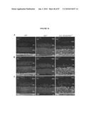 PHOTORECEPTOR PRECURSOR CELLS diagram and image