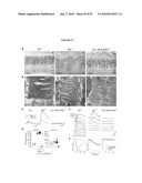 PHOTORECEPTOR PRECURSOR CELLS diagram and image