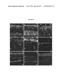 PHOTORECEPTOR PRECURSOR CELLS diagram and image