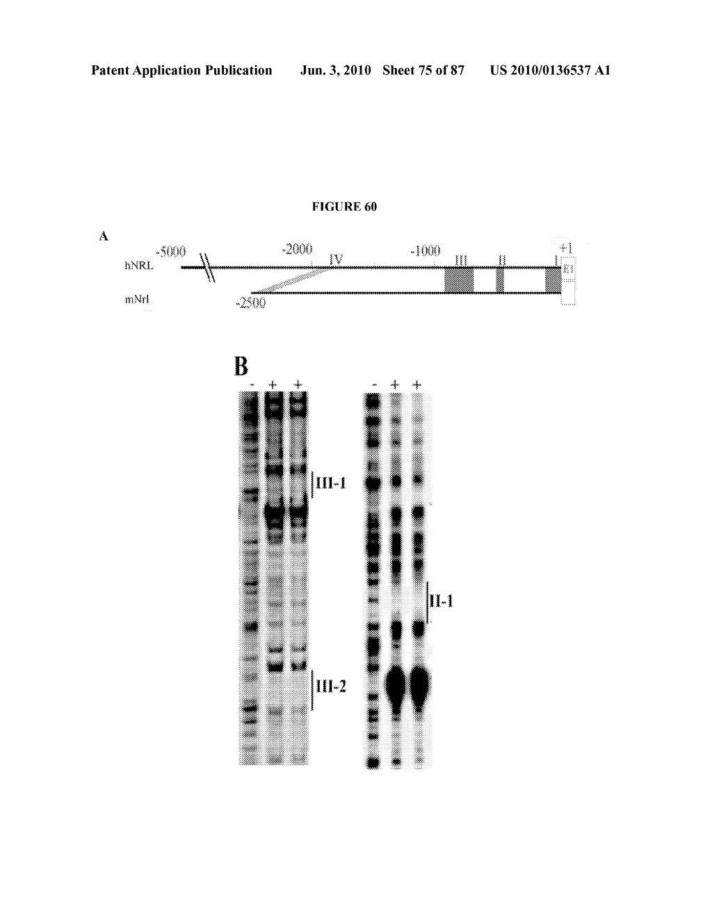 PHOTORECEPTOR PRECURSOR CELLS - diagram, schematic, and image 76