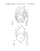 Torsion-Style Connector diagram and image