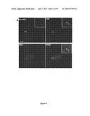 Compositions and Methods for the Treatment of Diseases Associated with Aberrant Cilia Assembly and Regulation diagram and image