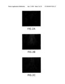 CADHERIN-11-MEDIATED MODULATION OF HAIR GROWTH diagram and image