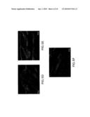 CADHERIN-11-MEDIATED MODULATION OF HAIR GROWTH diagram and image