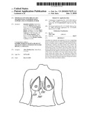 MINIMALLY INVASIVE BREAST LIFT METHOD WITH A SUPERIOR TISSUE SUPPORT AND AN INFERIOR ANCHOR diagram and image