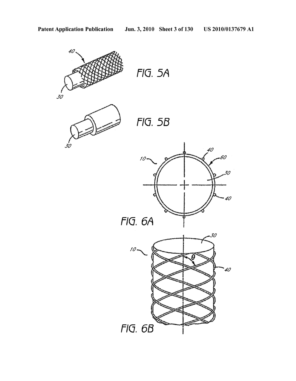 MINIMALLY INVASIVE BREAST LIFT METHOD WITH A SUPERIOR TISSUE SUPPORT AND AN INFERIOR ANCHOR - diagram, schematic, and image 04