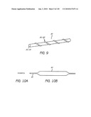 MINIMALLY INVASIVE BREAST LIFT METHOD WITH A SUPERIOR TISSUE SUPPORT AND AN INFERIOR ANCHOR diagram and image