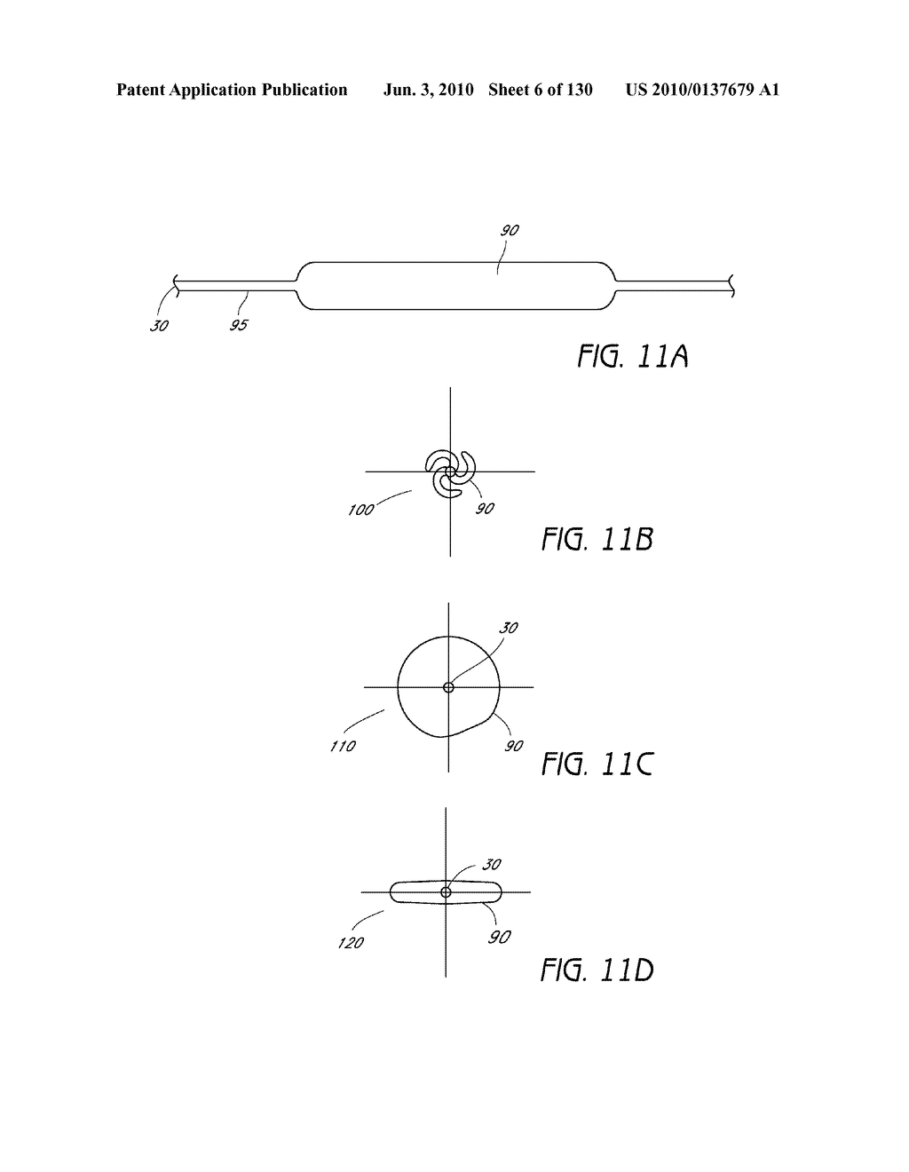 MINIMALLY INVASIVE BREAST LIFT METHOD WITH A SUPERIOR TISSUE SUPPORT AND AN INFERIOR ANCHOR - diagram, schematic, and image 07