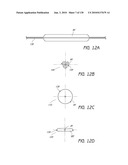 MINIMALLY INVASIVE BREAST LIFT METHOD WITH A SUPERIOR TISSUE SUPPORT AND AN INFERIOR ANCHOR diagram and image