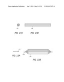 MINIMALLY INVASIVE BREAST LIFT METHOD WITH A SUPERIOR TISSUE SUPPORT AND AN INFERIOR ANCHOR diagram and image