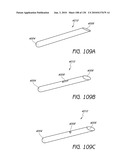 MINIMALLY INVASIVE BREAST LIFT METHOD WITH A SUPERIOR TISSUE SUPPORT AND AN INFERIOR ANCHOR diagram and image