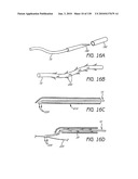 MINIMALLY INVASIVE BREAST LIFT METHOD WITH A SUPERIOR TISSUE SUPPORT AND AN INFERIOR ANCHOR diagram and image