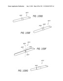 MINIMALLY INVASIVE BREAST LIFT METHOD WITH A SUPERIOR TISSUE SUPPORT AND AN INFERIOR ANCHOR diagram and image