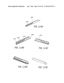 MINIMALLY INVASIVE BREAST LIFT METHOD WITH A SUPERIOR TISSUE SUPPORT AND AN INFERIOR ANCHOR diagram and image