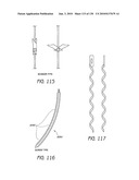 MINIMALLY INVASIVE BREAST LIFT METHOD WITH A SUPERIOR TISSUE SUPPORT AND AN INFERIOR ANCHOR diagram and image