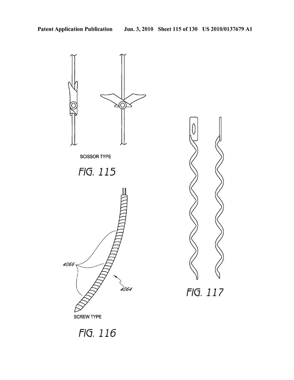 MINIMALLY INVASIVE BREAST LIFT METHOD WITH A SUPERIOR TISSUE SUPPORT AND AN INFERIOR ANCHOR - diagram, schematic, and image 116